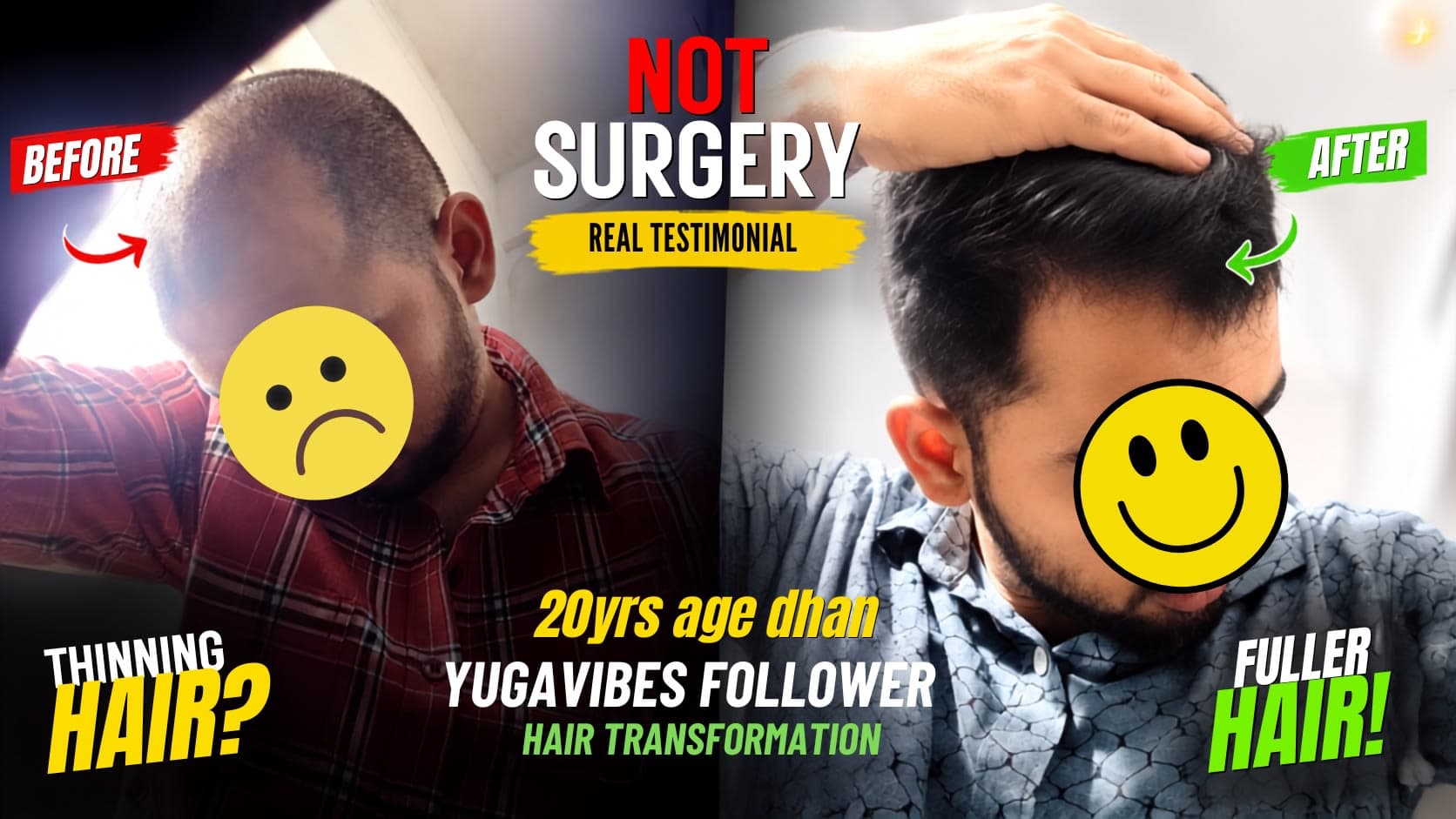 My hairline at week 1 next to week 12 of my routine